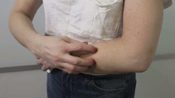 Frau kratzt sich mit Fingern an den Armen - Filmmaterial, Video