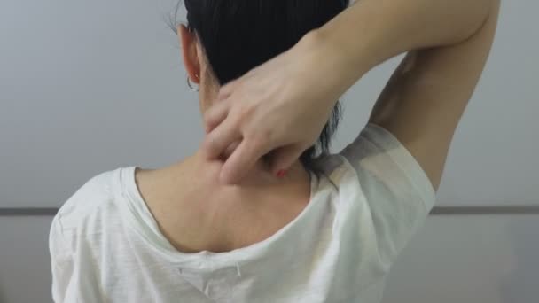 Женщина чешет свою зудящую шею аллергической сыпью
 - Кадры, видео