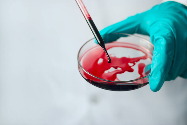Наука і медицина, вчений аналізує і скидає кров зразок у скляну посудину, експерименти, що містять хімічну рідину в лабораторних умовах, пандемія вірусу корони і Covid-19, медична технологія  - Фото, зображення