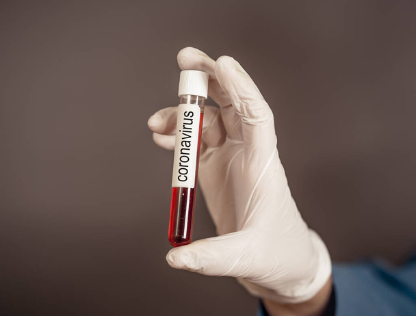 COVID-19. Doctor or lab technician scientist in Personal Protective Equipment holding vial of blood sample of infected patient at hospital. Coronavirus blood test for vaccine and medical treatment. - Φωτογραφία, εικόνα