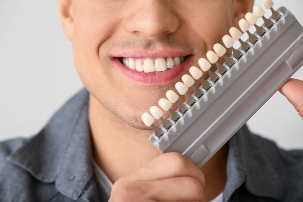 Homme avec des échantillons de couleur de dents sur fond clair, gros plan
 - Photo, image