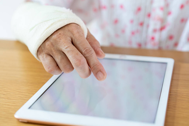 Injured arm woman reading an e-book on the tablet close up.  Healthcare and wellness in aging society concept. - 写真・画像