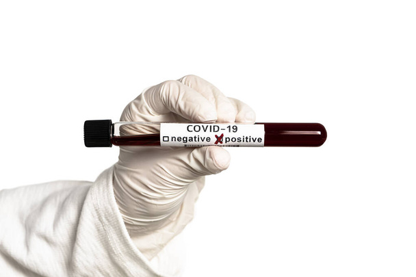 Hand tient une éprouvette contenant un échantillon de sang, une éprouvette pour l'analyse du coronavirus Covid-19. Échantillon des patients
 - Photo, image