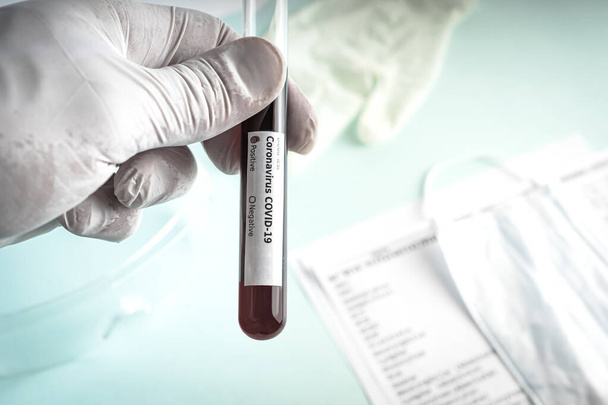 Το χέρι κρατά ένα δοκιμαστικό σωλήνα που περιέχει ένα δείγμα αίματος, δοκιμαστικό σωλήνα για Covid-19 coronavirus ανάλυση. Εργαστηριακές δοκιμές δειγμάτων ασθενών - Φωτογραφία, εικόνα