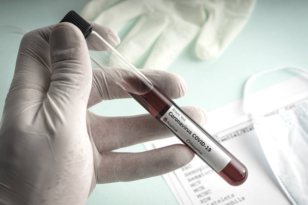 Hand hält ein Reagenzglas mit einer Blutprobe, Reagenzglas für Covid-19 Coronavirus-Analyse. Laboruntersuchungen an Patienten - Foto, Bild