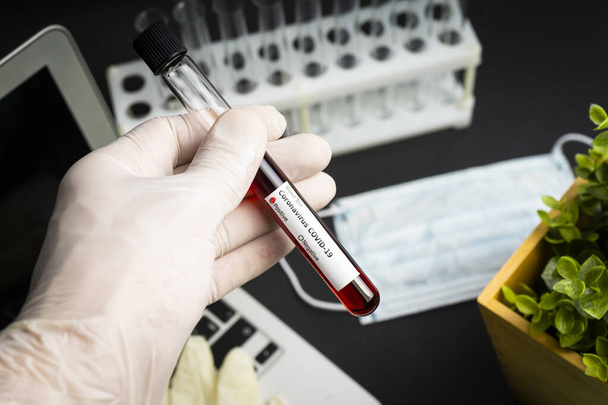 La mano sostiene un tubo de prueba que contiene una muestra de sangre, tubo de prueba para el análisis del coronavirus Covid-19. Prueba de laboratorio muestra de pacientes
 - Foto, imagen