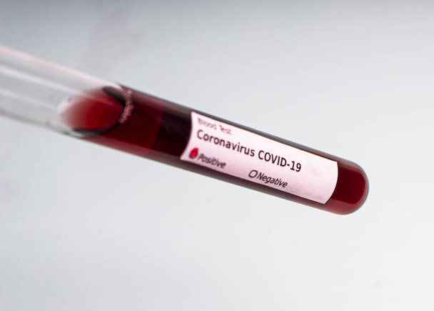 Tubo de ensayo que contiene una muestra de sangre, tubo de ensayo para el análisis de Covid-19 (coronavirus). Prueba de laboratorio muestra de pacientes
 - Foto, Imagen
