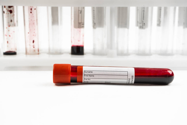 Vérmintákat tartalmazó kémcsövek fehér háttérrel, Covid-19 koronavírus analizáló kémcsővel. Laboratóriumi vizsgálati betegek mintája - Fotó, kép