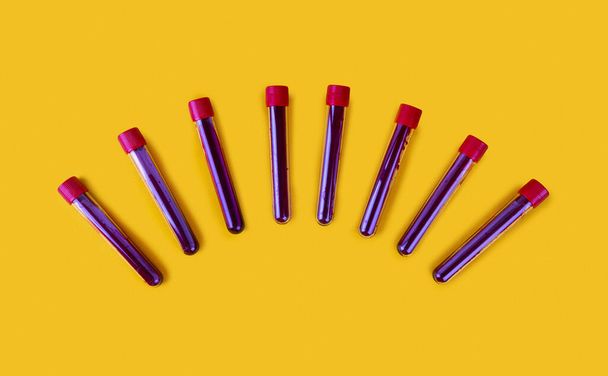 Test tubes containing a blood test samples over yellow background Laboratory testing patients sample - Photo, Image