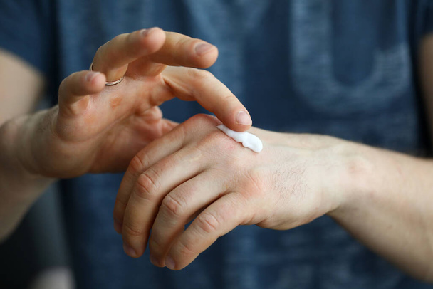 Mãos masculinas que aplicam a nata de umedecimento na pele
 - Foto, Imagem