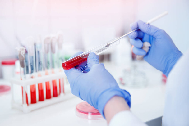 Enfermeira microbiologista segurando tubo de teste com sangue para coronavírus 2019-nCoV analisando
 - Foto, Imagem