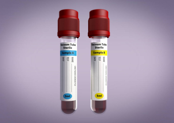 3d renderowanie dwóch plugawych próbek krwi z etykietami na szarym tle z miękkim naciskiem na plugastwa - Zdjęcie, obraz