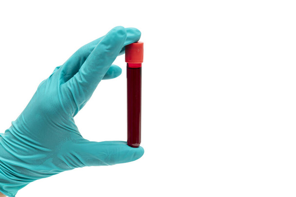 Mão com luva de borracha verde de segurança segurando tubo sanguíneo com sangue isolado em fundo branco e foco seletivo
 - Foto, Imagem