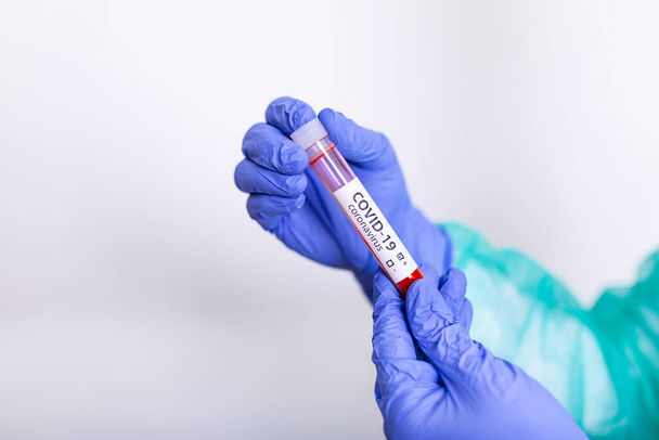Resultado positivo de la prueba mediante el uso de un dispositivo de prueba rápida para el virus COVID-19, nuevo coronavirus 2019. Coronavirus Covid 19 muestra de sangre infectada en un tubo de muestra en la mano de un médico protección contra riesgos biológicos
 - Foto, imagen