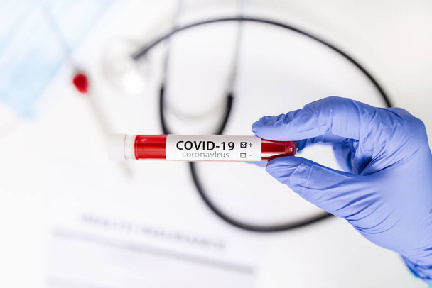 лабораторний технік тримає пробну трубку крові для тесту на коронавірус, тест COVID 19
 - Фото, зображення