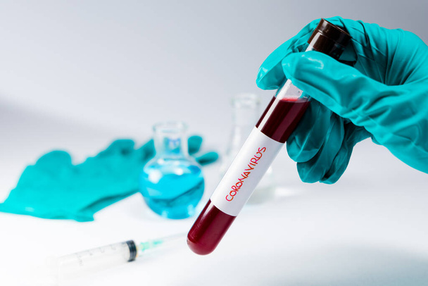 Mão de um médico segurando um tubo de teste de vidro cheio de sangue de pacientes para ser testado para o vírus altamente letal e infeccioso Corona
. - Foto, Imagem