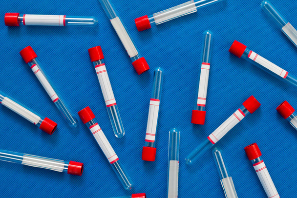 Testbuisjes zijn leeg op een blauwe achtergrond voor analyses - Foto, afbeelding