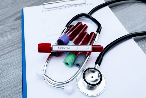 Das Bild des Blutröhrchens mit Coronavirus-Test und Stethoskop auf weißem Hintergrund. - Foto, Bild