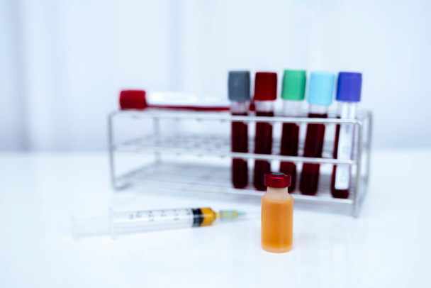 The picture of yellow serum tube and blood tube of coronavirus test in white background. - 写真・画像