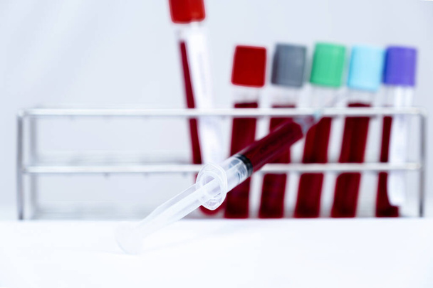A imagem do tubo sanguíneo do teste de coronavírus e seringa em fundo branco
. - Foto, Imagem