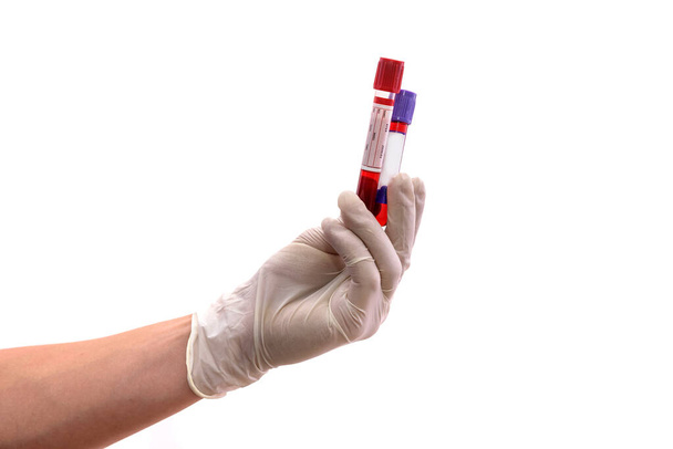 白に隔離された赤い試験管を持つ人間の手。医学的概念 - 写真・画像