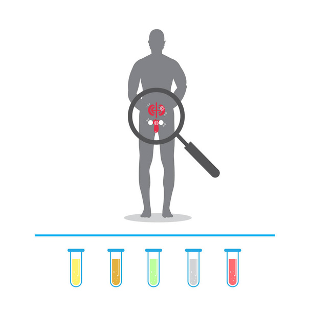 cuerpo humano con cálculos renales. prueba de orina. signos de iconos para gráficos web
 - Vector, Imagen
