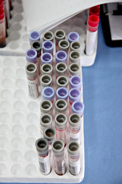 Tubos que utilizam amostras de sangue a examinar
. - Foto, Imagem