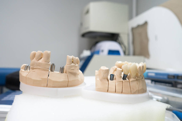 miejsce pracy technika dentystycznego do produkcji protez dentystycznych na implantach - Zdjęcie, obraz