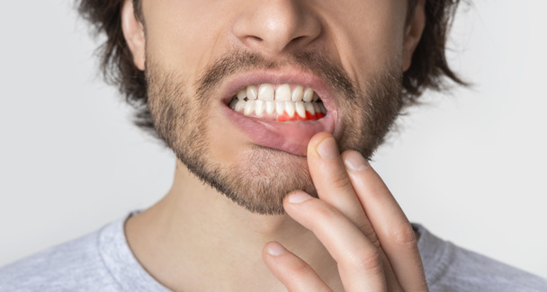 Homme souffrant de maux de dents, de carie dentaire ou de sensibilité
 - Photo, image