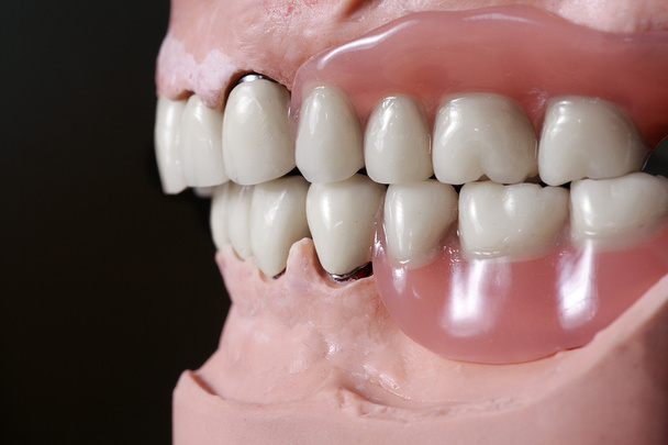 dentition after treatment - Foto, Bild