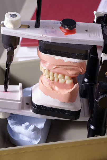 Jaw in the laboratory - Photo, Image