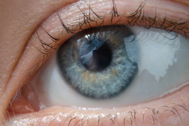 Macro photo of a female eye of blue color with yellow splashes - Photo, Image