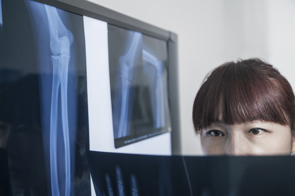 Doctor mirando rayos X de huesos humanos
 - Foto, Imagen
