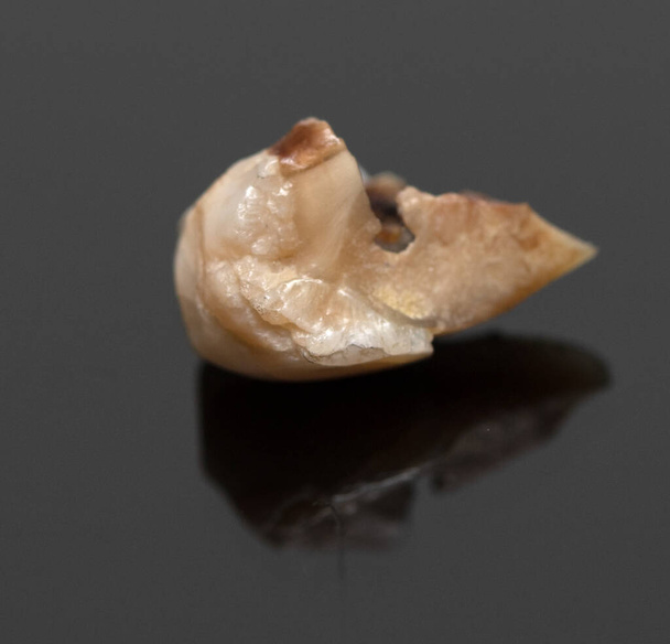 Human tooth caries on a black background. - Photo, Image