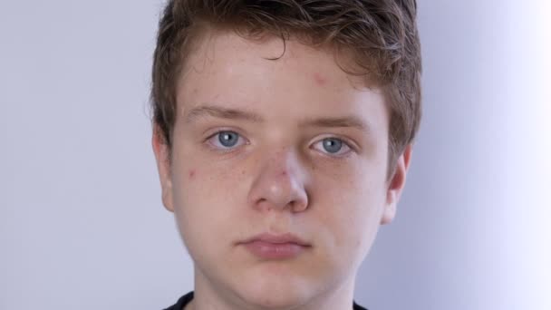 Ένα χαριτωμένο έφηβος αγόρι με ξανθά μαλλιά και μπλε μάτια με πρόβλημα του δέρματος και της εφηβικής ακμής κοιτάζει την κάμερα σε λευκό φόντο. Δερματολογικά προβλήματα σε έφηβο. Νεαρός σε μεταβατική ηλικία - Πλάνα, βίντεο