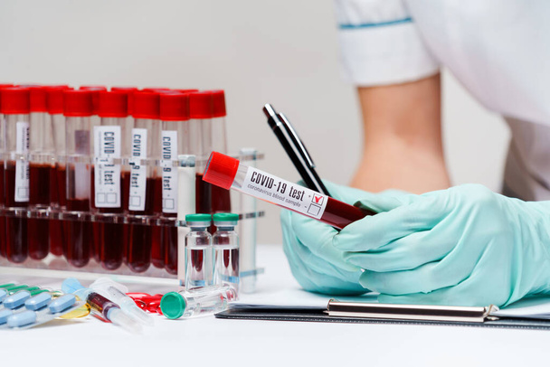 woman docxtor working with blood test tubes - Fotografie, Obrázek