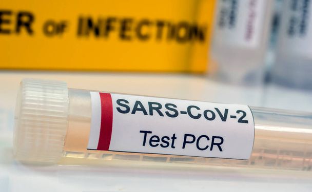 Vial pcr de SarsCov2 coronavirus, imagen conceptual - Foto, Imagen