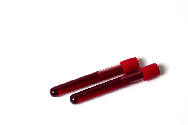 Kaksi koeputkea, joissa on verisolaatti valkoisella pohjalla. Lääketieteen käsite, virusten ja bakteerien torjunta, sairaudet
 - Valokuva, kuva