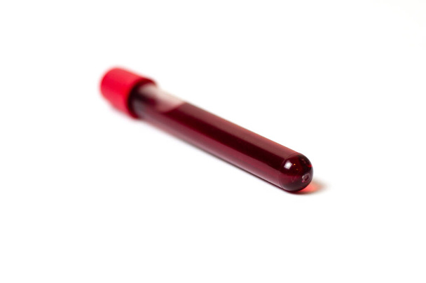 Testbuis met bloedisolaat op een witte achtergrond - Foto, afbeelding