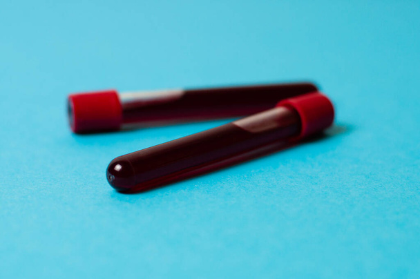 Two test tubes with blood isolate on a blue background. The concept of medicine, the fight against viruses and bacteria, diseases - Zdjęcie, obraz