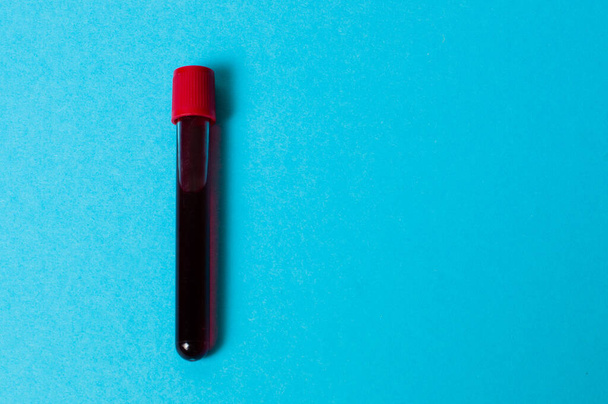 Test tube with blood isolate on blue background - Foto, Imagen