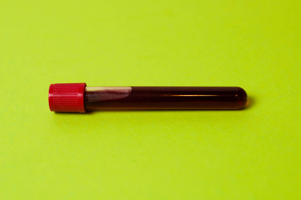 Testbuis met bloedisolaat op groene achtergrond - Foto, afbeelding
