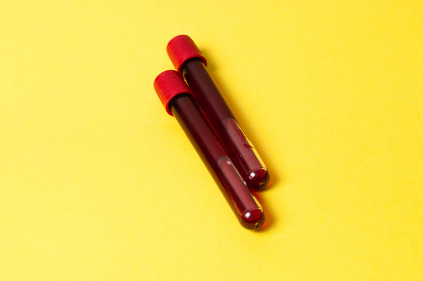Two test tubes with blood isolate on a yellow background. Concept medicine, the fight against viruses and bacteria, diseases - Foto, afbeelding