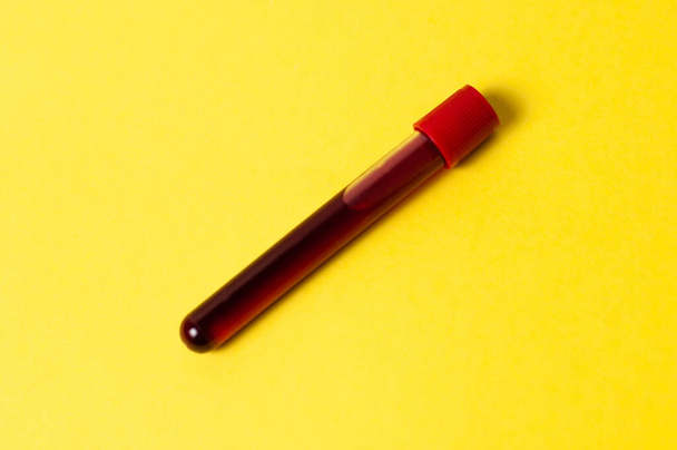 Tubo de ensayo con aislado de sangre sobre fondo amarillo
 - Foto, imagen