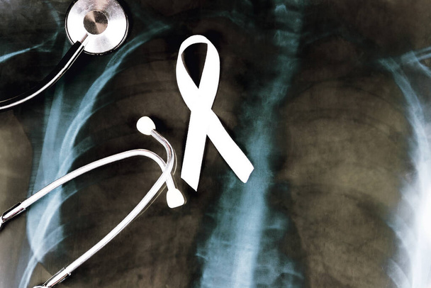 Onkologisen sairauden käsite. Valkoinen nauha symbolina keuhkosyöpä ja stetoskooppi makaa keuhkojen röntgenkuva
. - Valokuva, kuva
