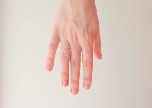 A trace from the wedding ring on the ring finger. Female hand shows the trace of the engagement ring. - 写真・画像