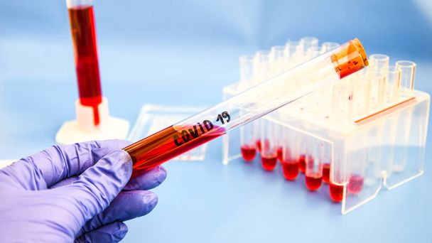 Coronavirus Muestra de sangre, análisis de ADN de la sangre en el laboratorio y tubos de extracción de muestras de sangre y jeringa con ADN moderno interfaz de fondo azul, virus covid-19
 - Foto, Imagen