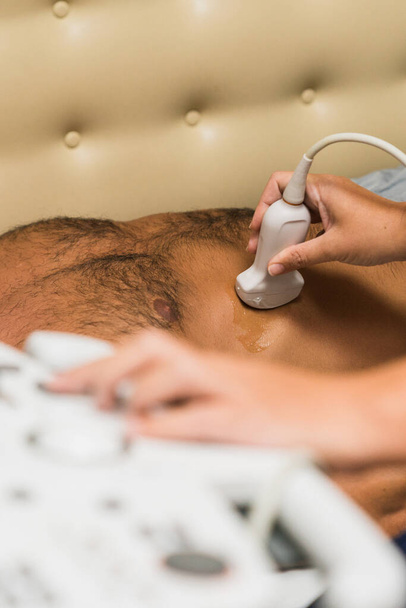 Detailní záběr muže na ultrazvukové vyšetření břicha lékařem. - Fotografie, Obrázek