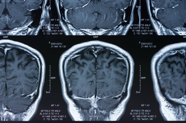 imagen de resonancia magnética, resonancia magnética del cerebro
. - Foto, Imagen