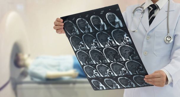 El médico examinará la radiografía de la película del cerebro mediante una resonancia magnética del paciente
. - Foto, imagen